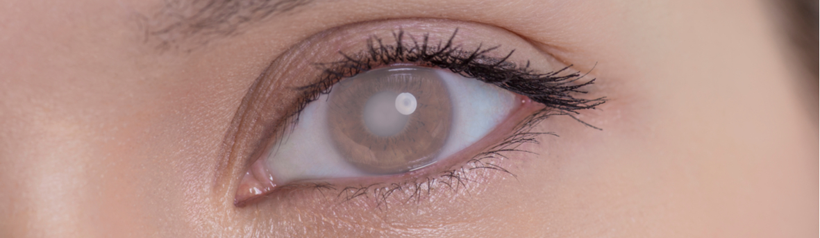 Wat is nastaar? Heb ik nastaar? War zijn de symptomen van nastaar? Behandeling van nastaar