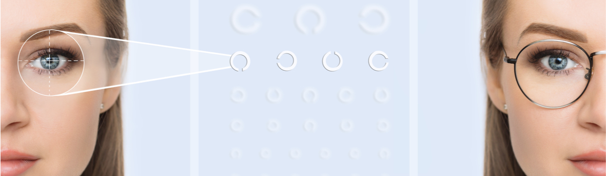 Wat is bijziendheid? Ik zie veraf niet goed. Heb ik een bril met minsterkte nodig?